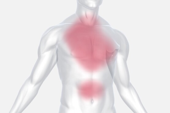 Typische Schmerzstellen bei Angina pectoris